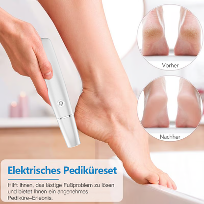 🔥Neujahrsangebot 50% Rabatt - Elektrischer Hornhautentferner🎁1*Ersatzkopf inklusive🎁